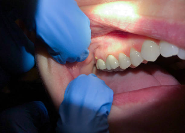Best Weekend Emergency Dentist in Laverne, OK