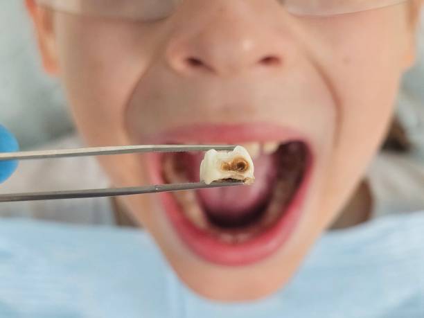 Best Emergency Dental Surgery in Laverne, OK